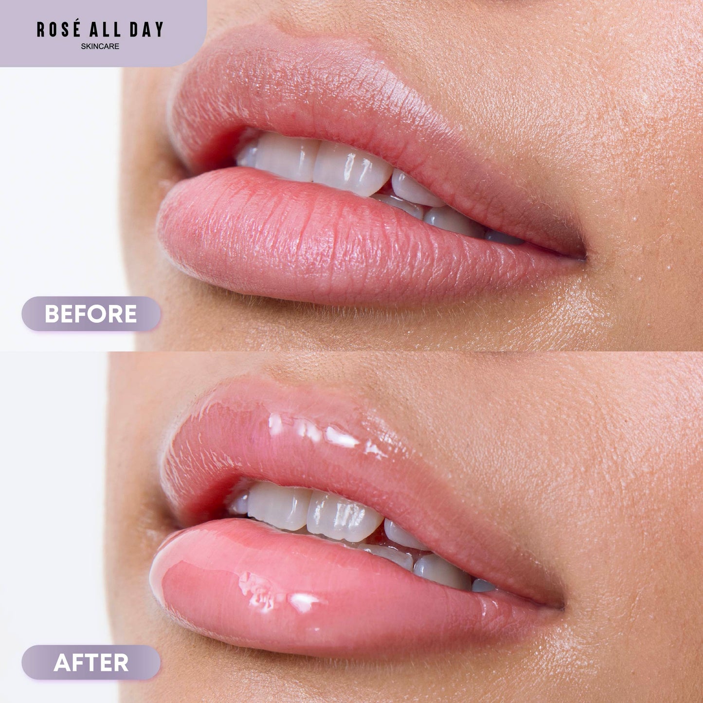 Rosé All Day Tripeptide Lip Care