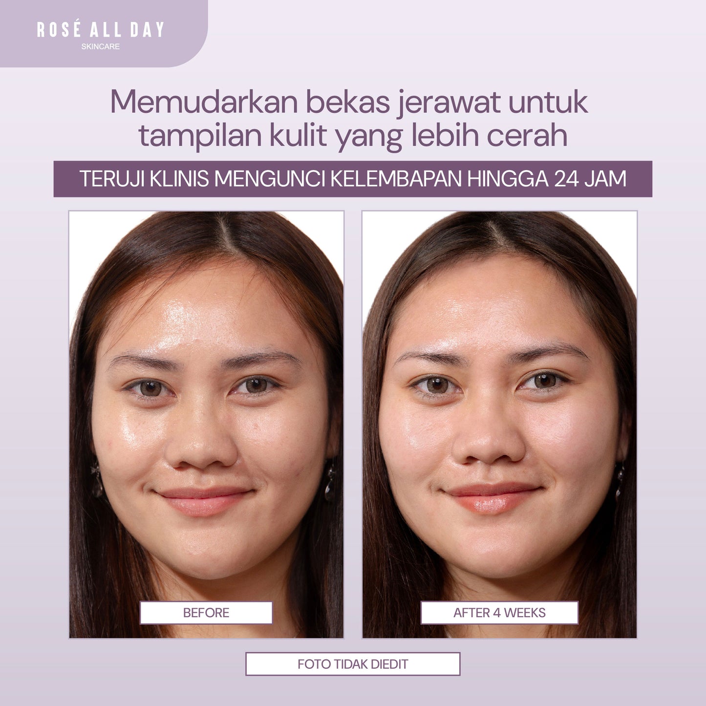 Double Surge Barrier Moisturizer