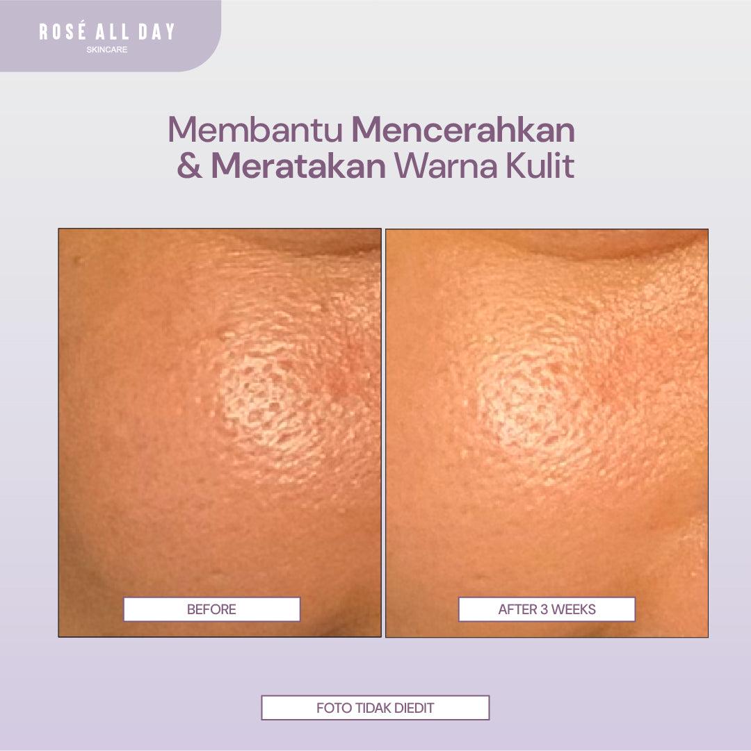 Rose All Day SKINFIX+ Brightening & Dark Spot Toner 100ml
