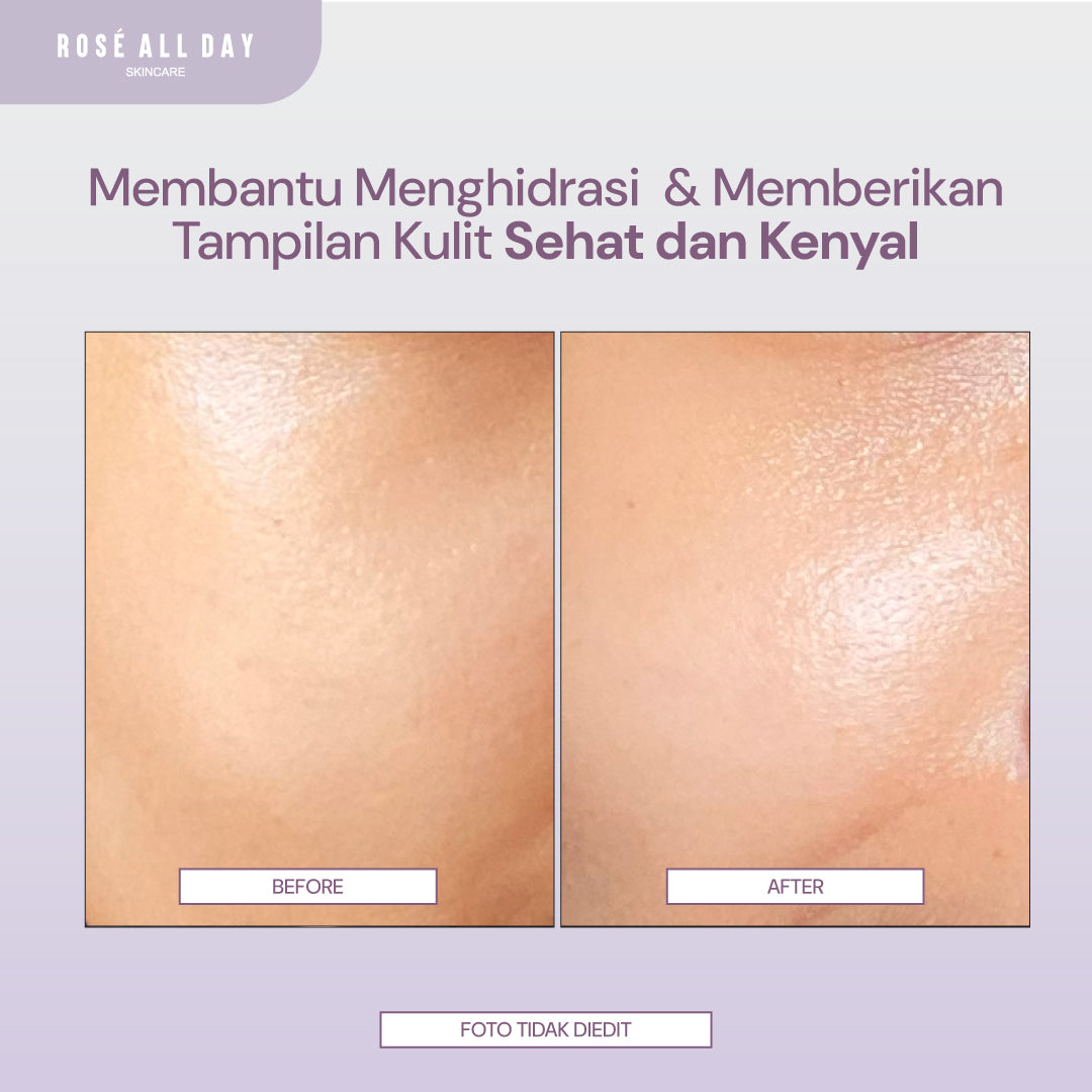 Rose All Day SKINFIX+ Triple Hydration + Barrier Boost Toner 100ml