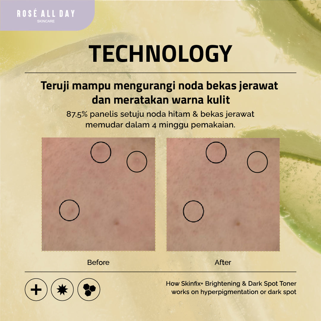 Rose All Day SKINFIX+ Brightening & Dark Spot Toner 100ml